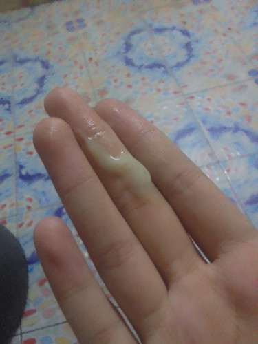 มีเเบบนี้ไหลออกทั้งวันอันตรายไหมคะ