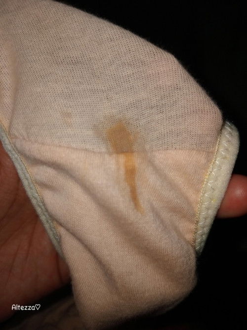 Usia kandungan 39 week di CD ada noda