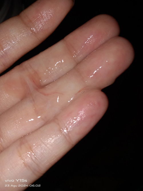 Usia kandungan 36 minggu