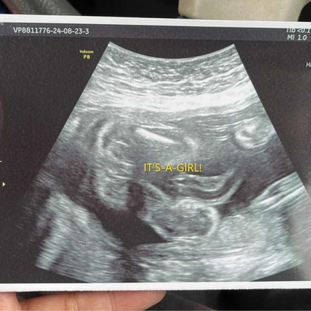 Girl or boy