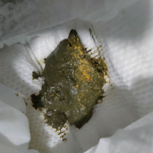 change formula milk naging black tae ni baby