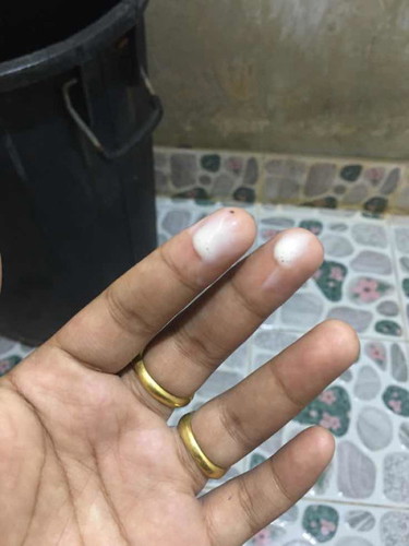 แบบนี้อันตรายมั้ยคะ