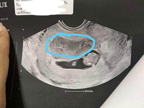 ขอสอบถามหน่อยค่ะ