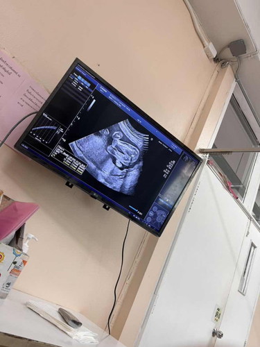 ขอความคิดเห็นแม่ๆ