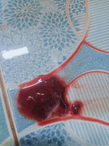 Ini keguguran atau apa yah bun