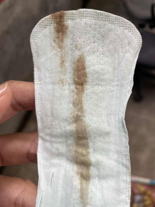 Flek di usia 10 week