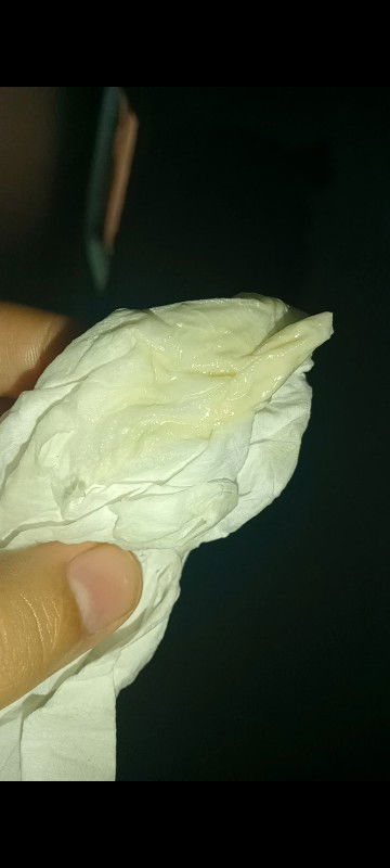 Bun ada yang sama keluar keputihan kaya gini? Itu normal ga yah?