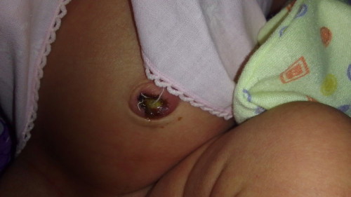 Puput di hari ke 5