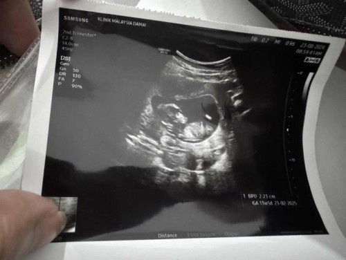 13 week scan tak sabar mau gender scan pling awal nak tahu brp weeks?