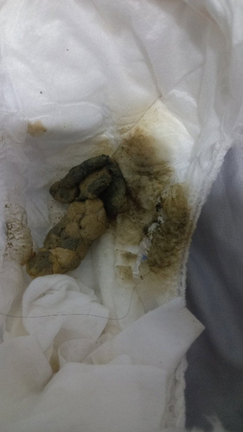 Warna bab usia 8bulan