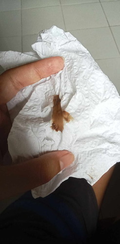 แบบนี้คืออะไร