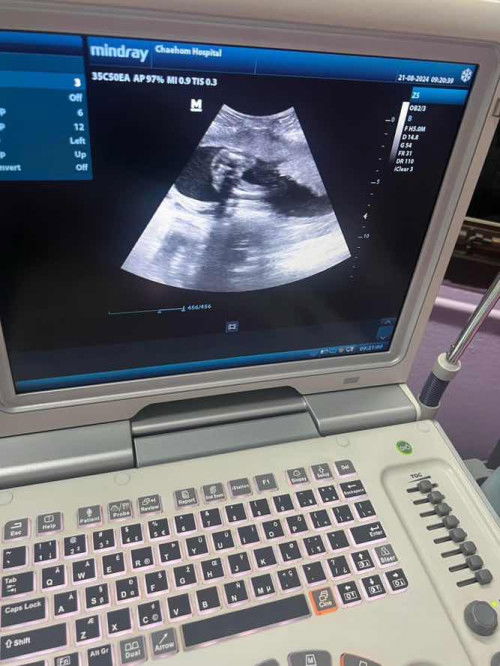 แม่ๆช่วยดูเพศให้หน่อยค่ะว่าเป็นเพศหญิง-ชาย 🤣