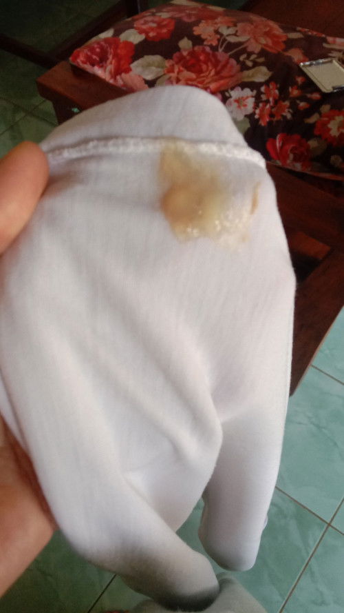 Mf bun sdkit jorok ,mau tanya apakah ini lndir tnda persalinan ? Mohon bantuannya Bun ,trmksh