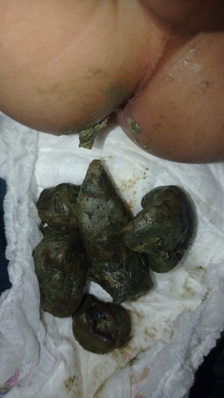 Sembelit bayi 7 bulan