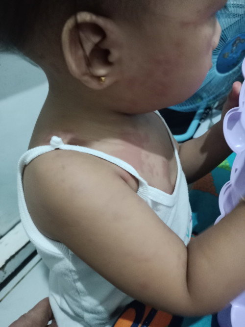 Please pasagot nman po ano ito binigyan n apo sya NG cetirizine kahpon Lang mgstart ito NG 8pm