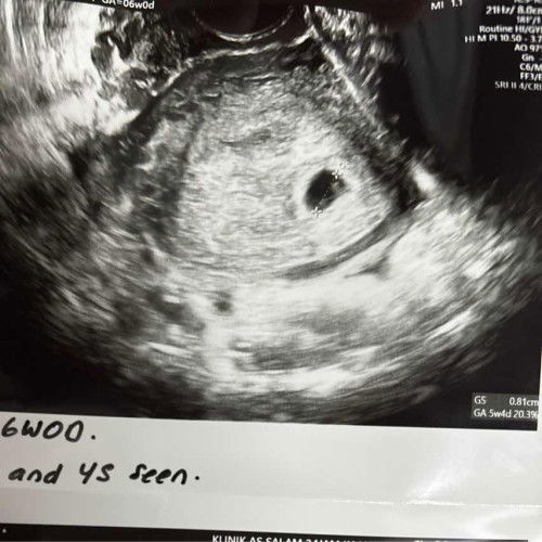 Cuma ada Yolk Sac je 6w