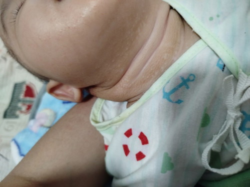 ครีมทาผื่น