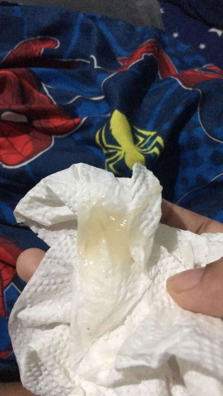 มูกใสกี่วันจะคลอดคะ