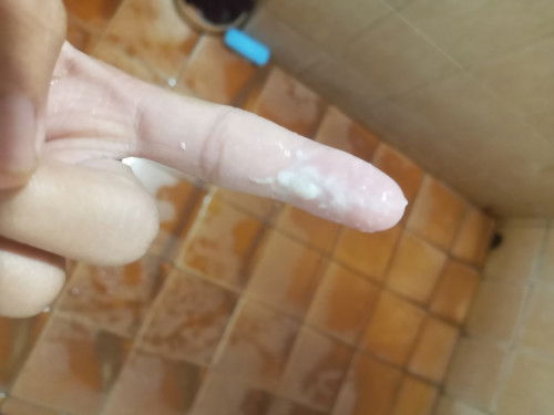 ตกขาวเเบบนี้อันตรายมั้ยค่ะ