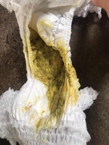 น้อง6เดืนท้องเสีย