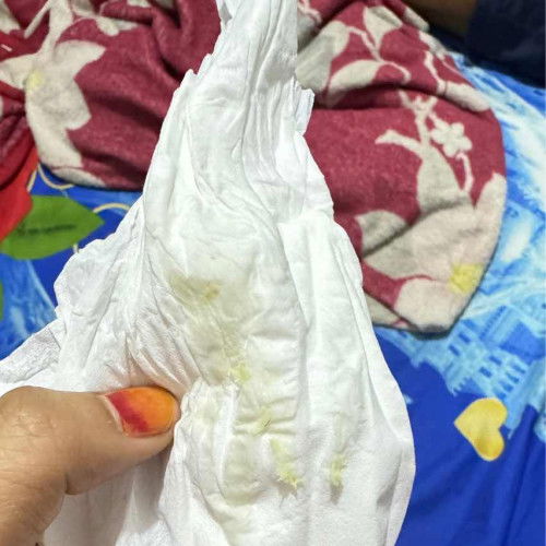 Keputihan saat hamil