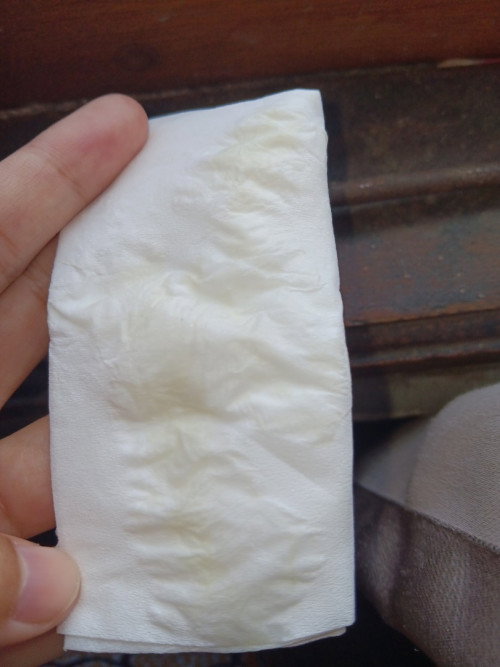 Keputihan saat hamil