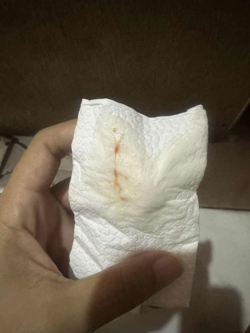 Spotting . Red blood po.