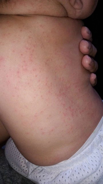 Hi mommy semua nak ni bintik ruam ke ni atau apa🥺