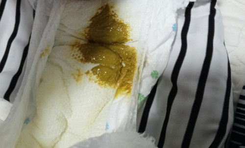 normal lang po ba poop ni baby mix po siya at medyo may amoy nawoworry po kase ako