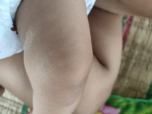 อยากทราบน้องเป็นอะไรคะ