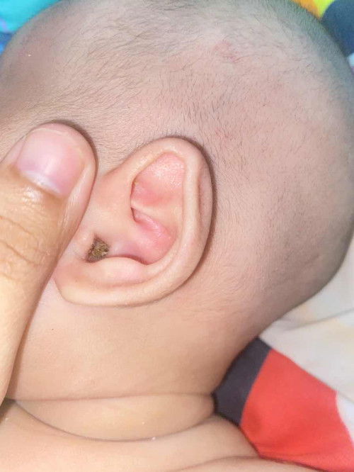 ขี้หูแห้งเยอะ.