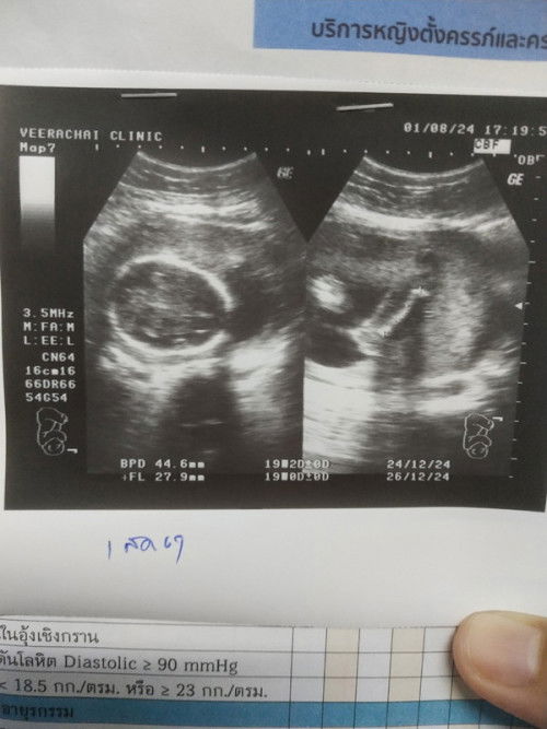 22W 4D ได้ลูกชายจ้า