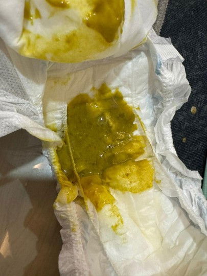 hi.. nk tnye normal ke anak saya berak mcm ni..tiap kali abis susu..3 mcm tu..terus berak..