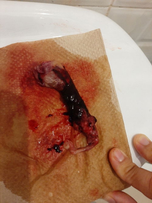 Bunda ada yg tau ini apa ya??