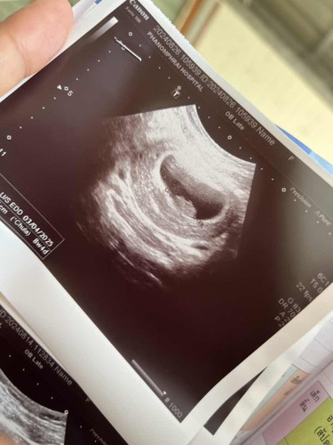 รบกวนแม่ๆมาแชร์ประสบการณ์กันหน่อยค่ะ