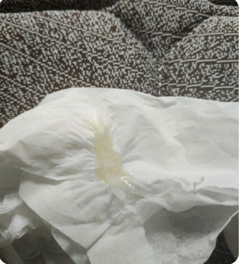 Keluar lendir keputihan di TM 1