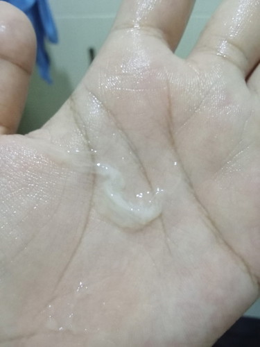 แบบนี้ใกล้คลอดรึยังคะ