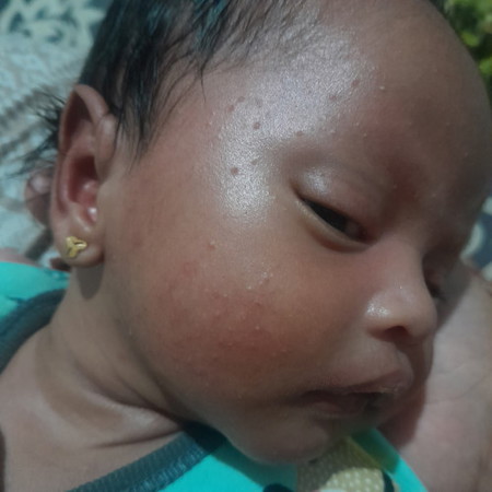 Muka bintik kecil
Izun tanya penanganannya bagaimana ya
Please help me