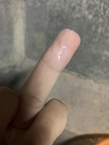 ตกขาว มูกใส หรืออะไรคะ