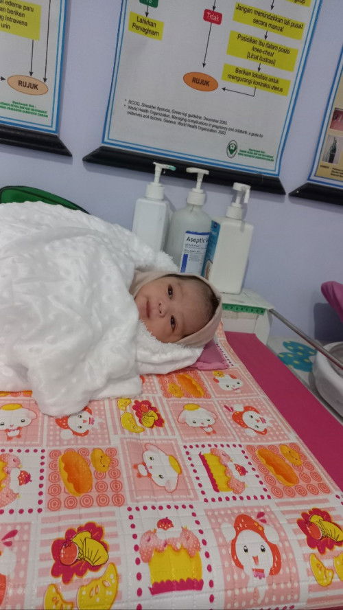 Bayi lahir 42 minggu