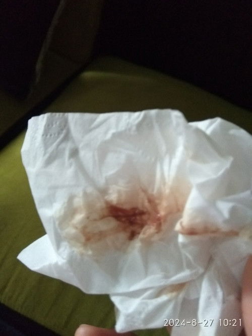 Tiap hari ngflek Bun 😭