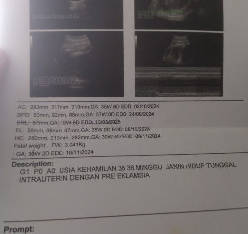 Hasil USG 36week