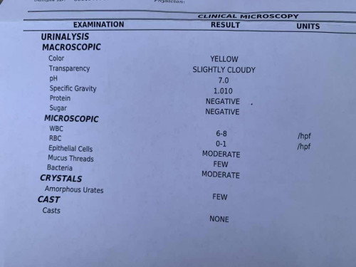 Irinary test
