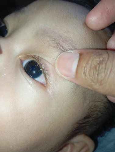 พึ่งสังเกตว่ตาขาวแดง