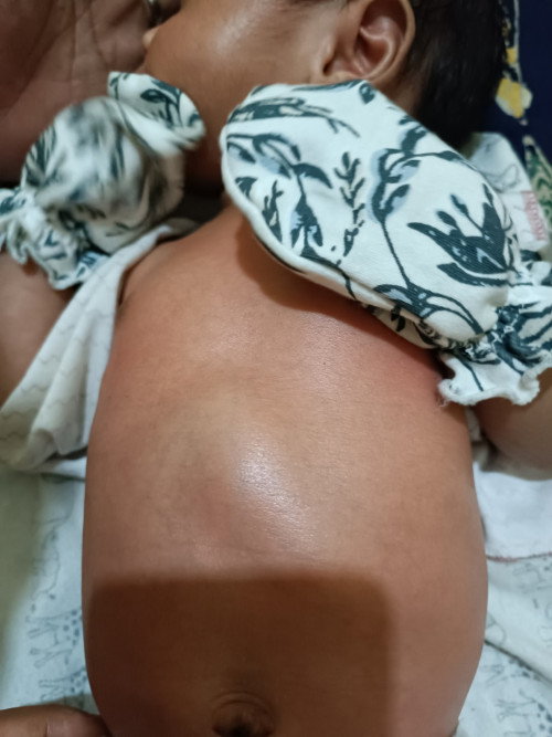 Perut newborn