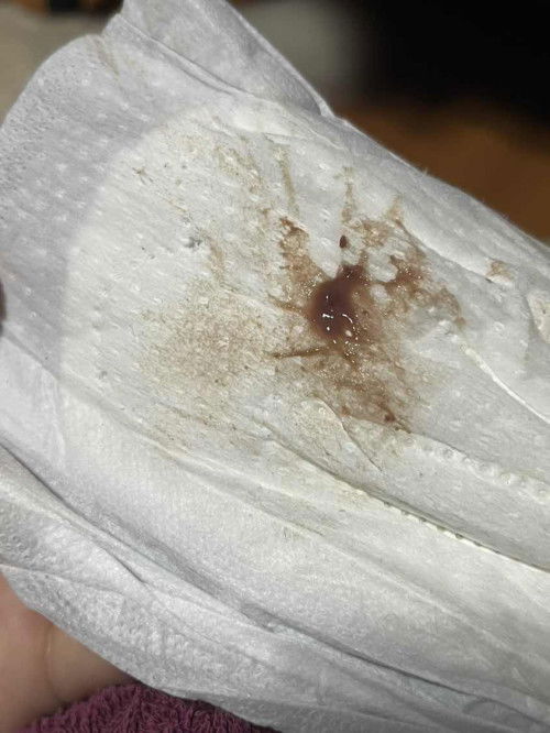 ไม่มีอาการปวดเลือดสีนี้คืออะไรคะ