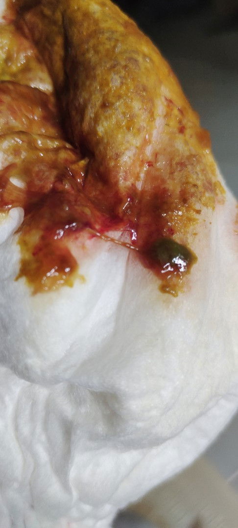 Bab ada lendir darah