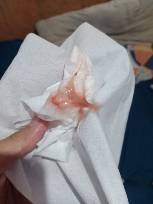 Keluar lendir tanpa kontraksi