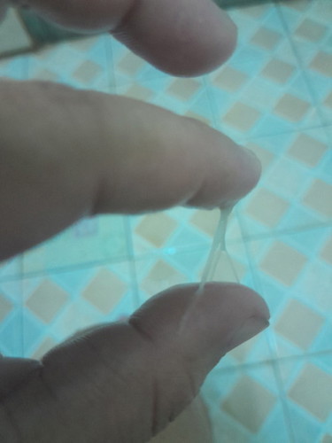 อายุครรภ์ 32W+4D มีมูกใสๆกับอาการปวดท้องบีบๆ ถี่ ปวดแบบมีลมจะปวดดถ่ายค้ะ