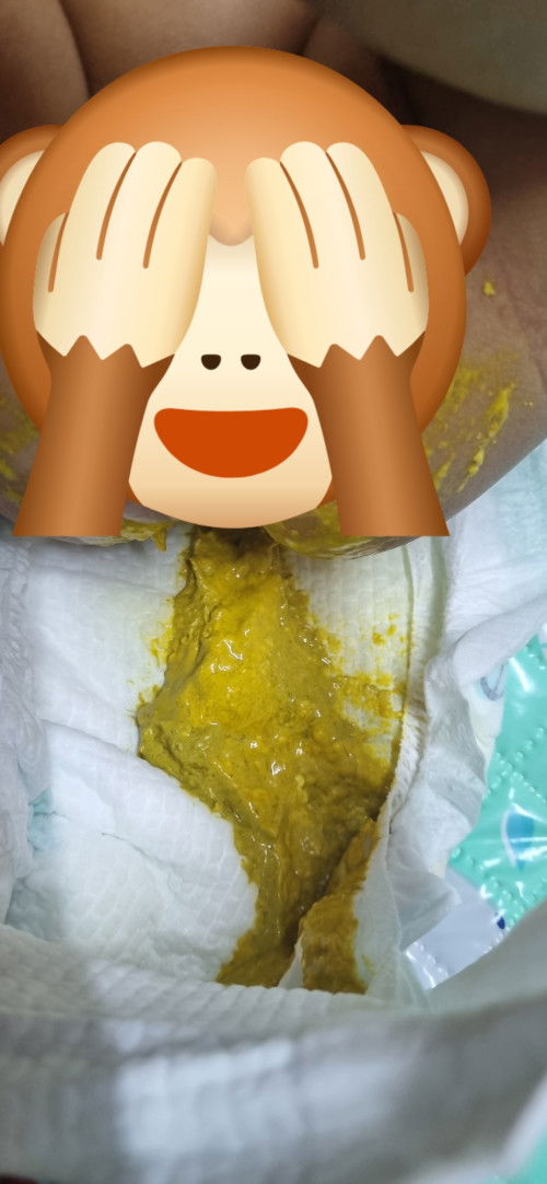 Kalau najis macam ni perlu tuka susu ke?